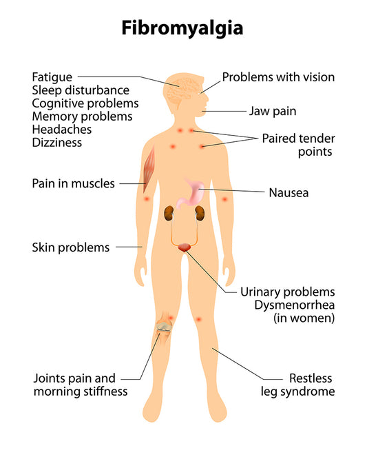 Fibromyalgia